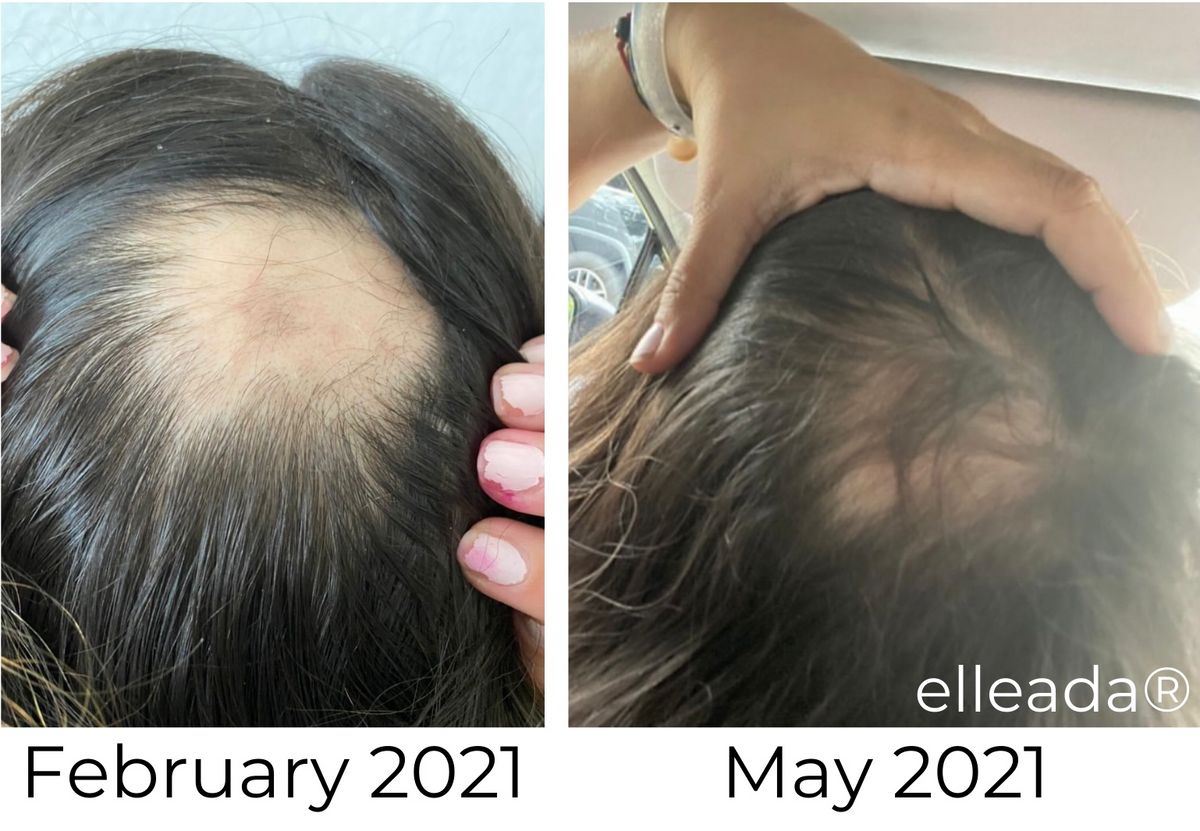 Elleada's Hair Serum