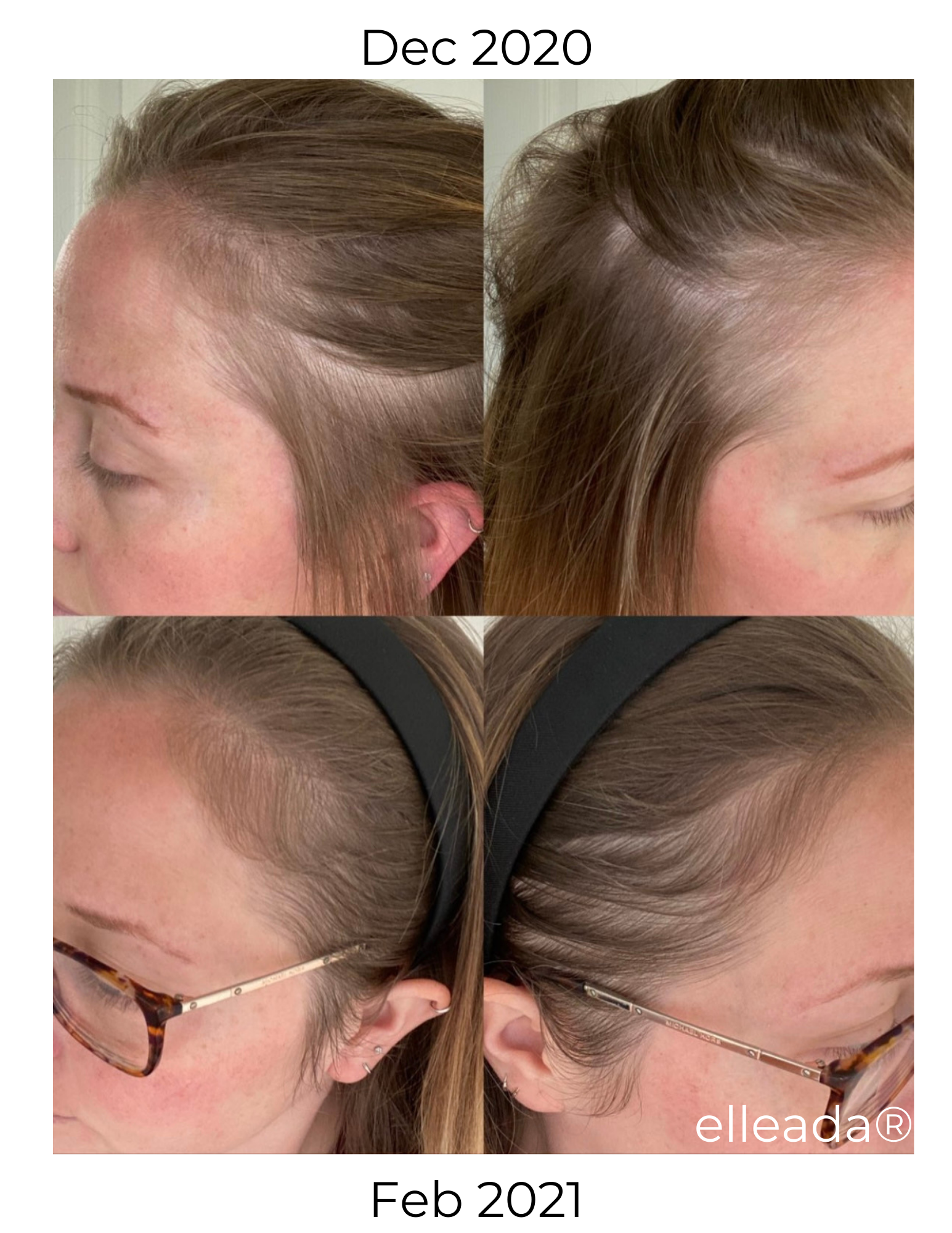 Hair Strengthening Serum - All Natural, Vegan, Hair loss, Dry/Itchy Scalp