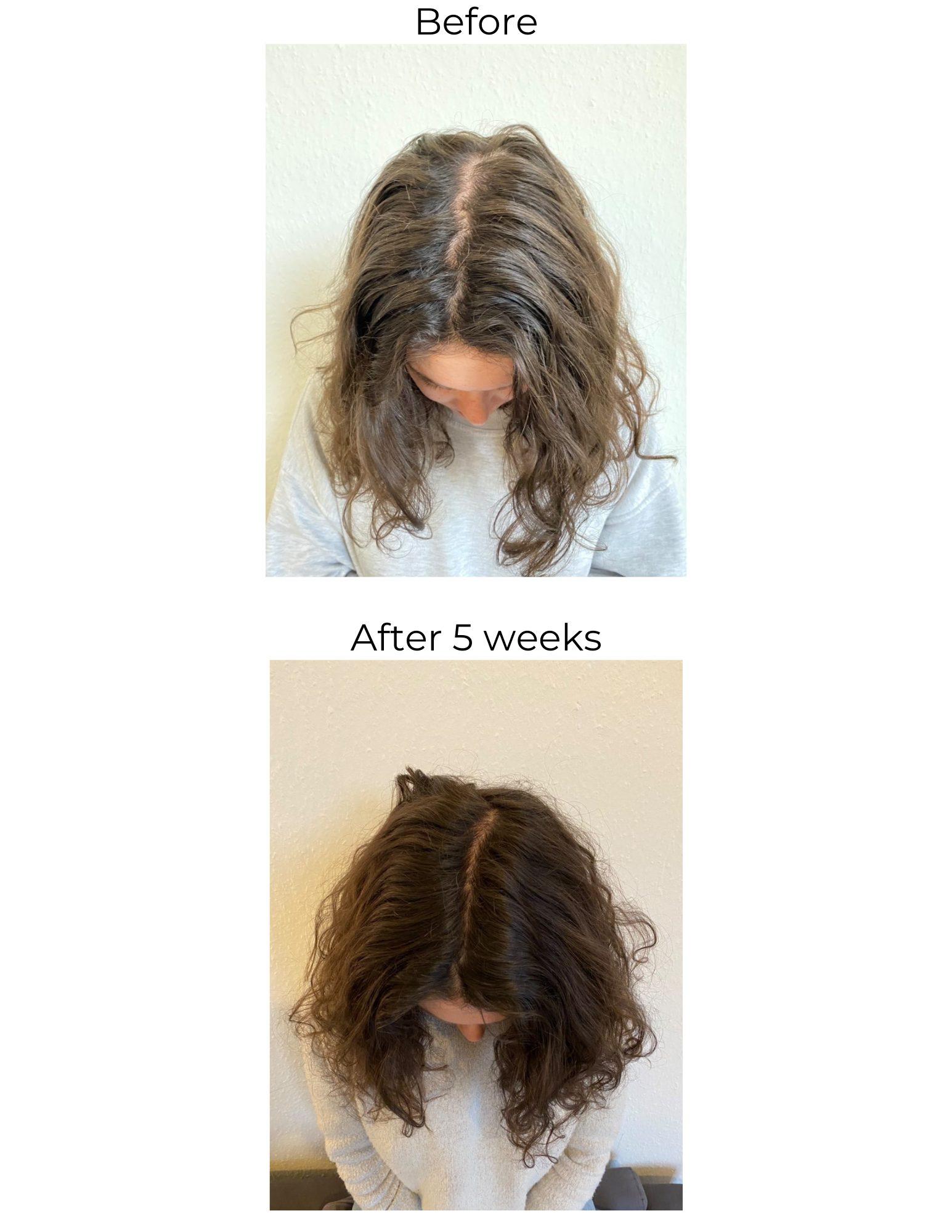 Hair Strengthening Serum - All Natural, Vegan, Hair loss, Dry/Itchy Scalp