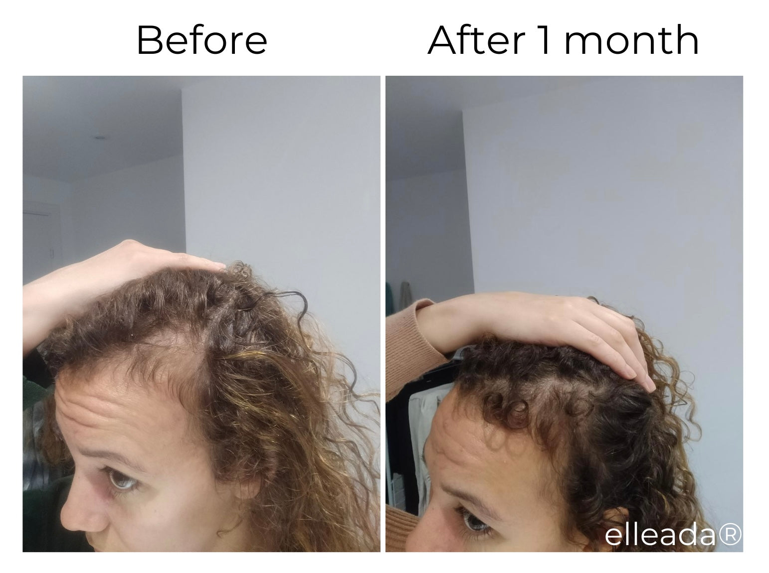 Hair Strengthening Serum - All Natural, Vegan, Hair loss, Dry/Itchy Scalp