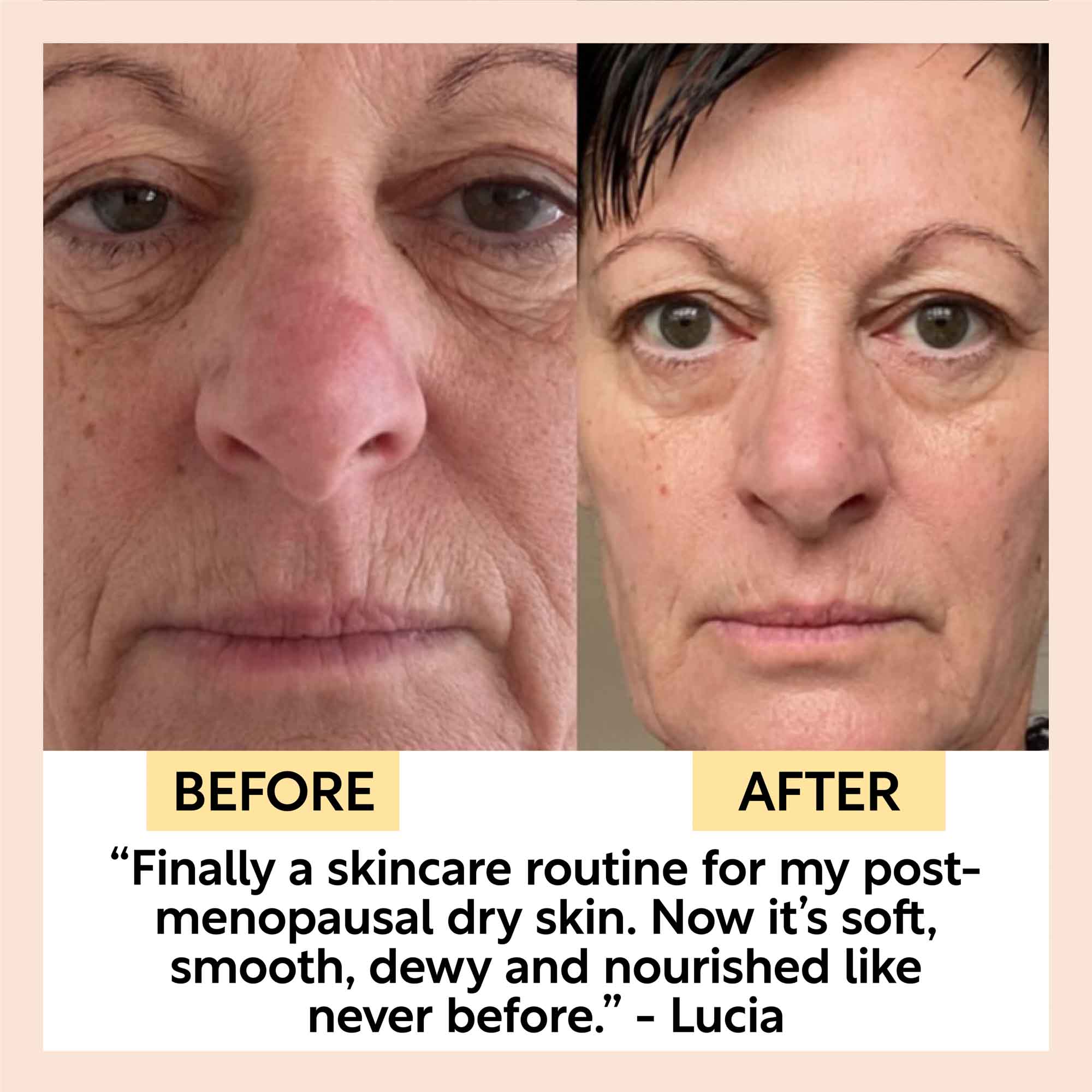 Eye Cream