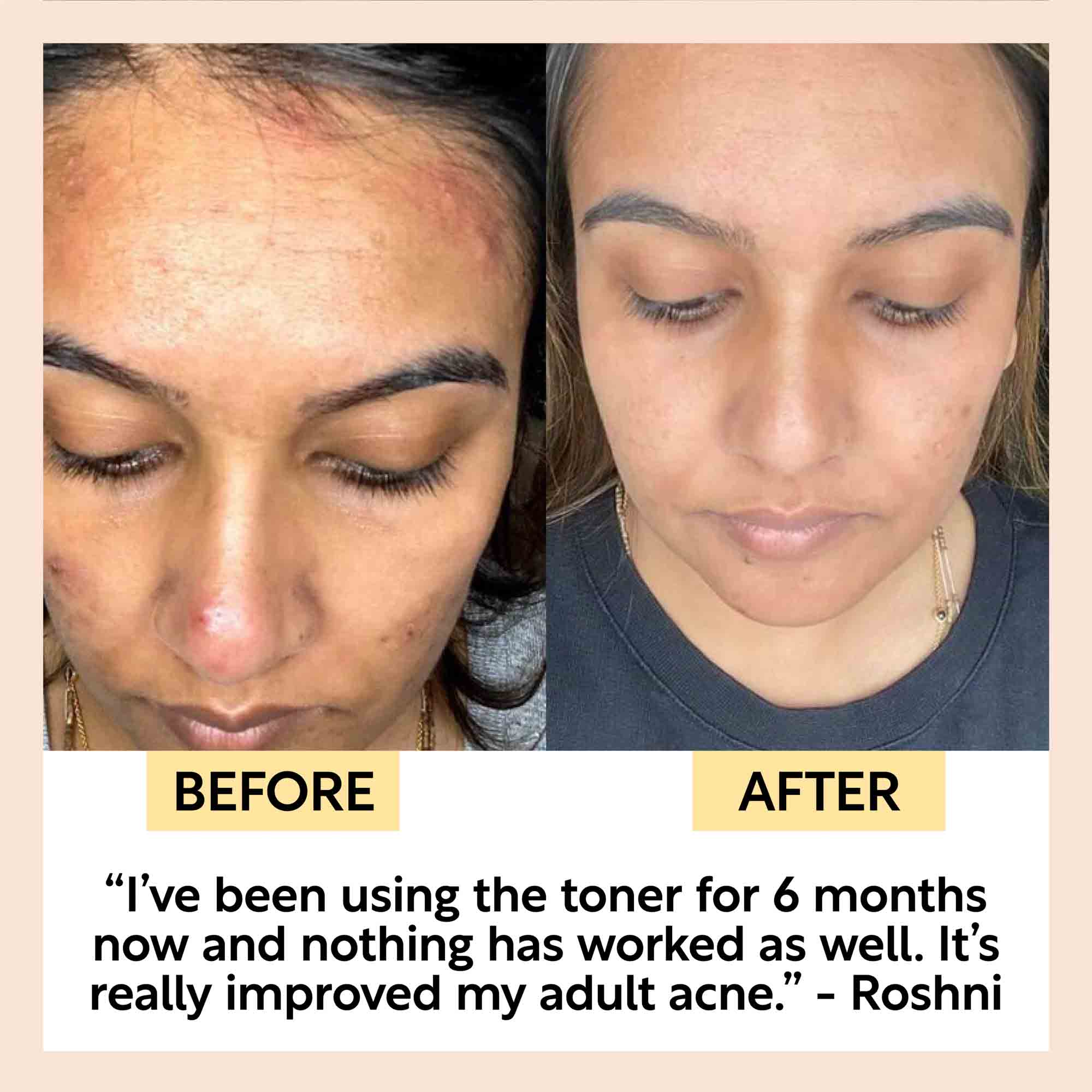 Face Toner