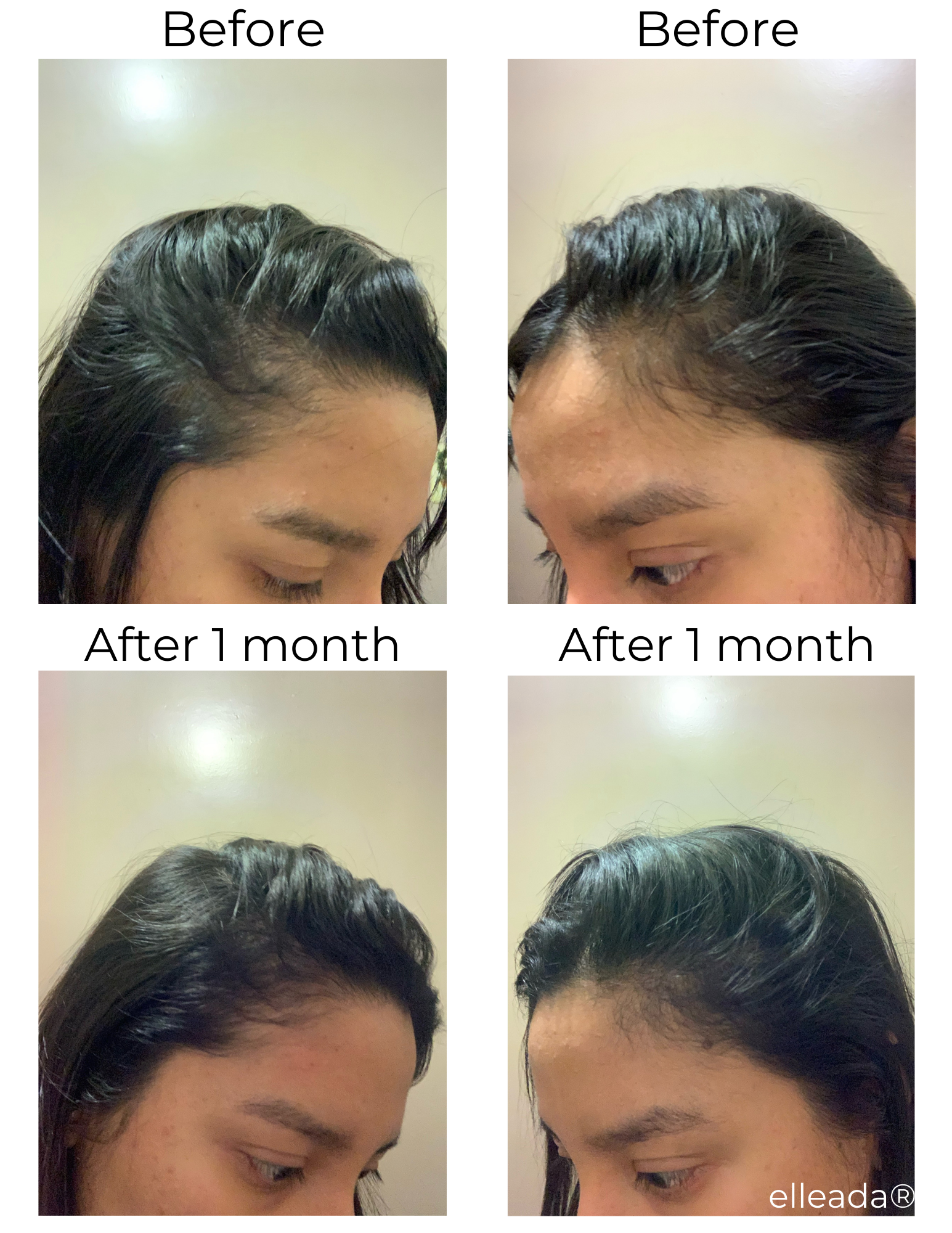 Hair Strengthening Serum - All Natural, Vegan, Hair loss, Dry/Itchy Scalp