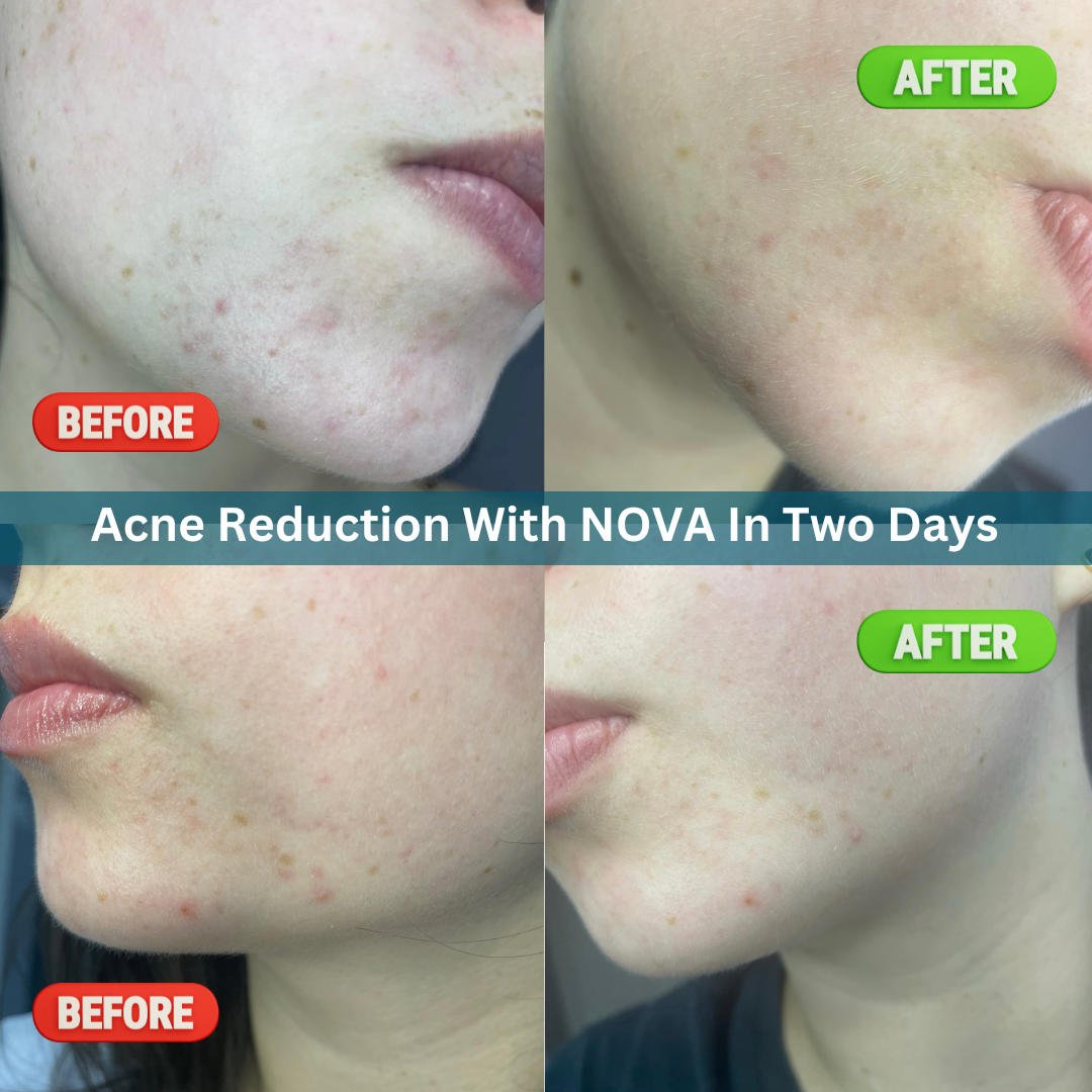 Nova Jelly Serum Bar Refill