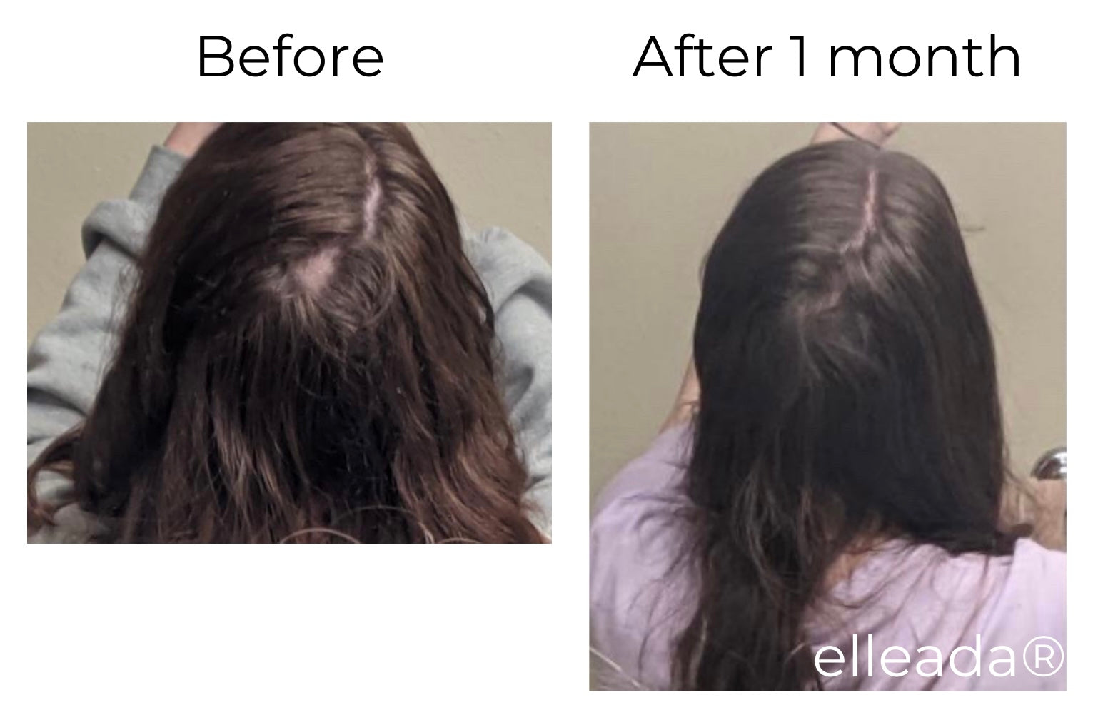 Hair Strengthening Serum - All Natural, Vegan, Hair loss, Dry/Itchy Scalp