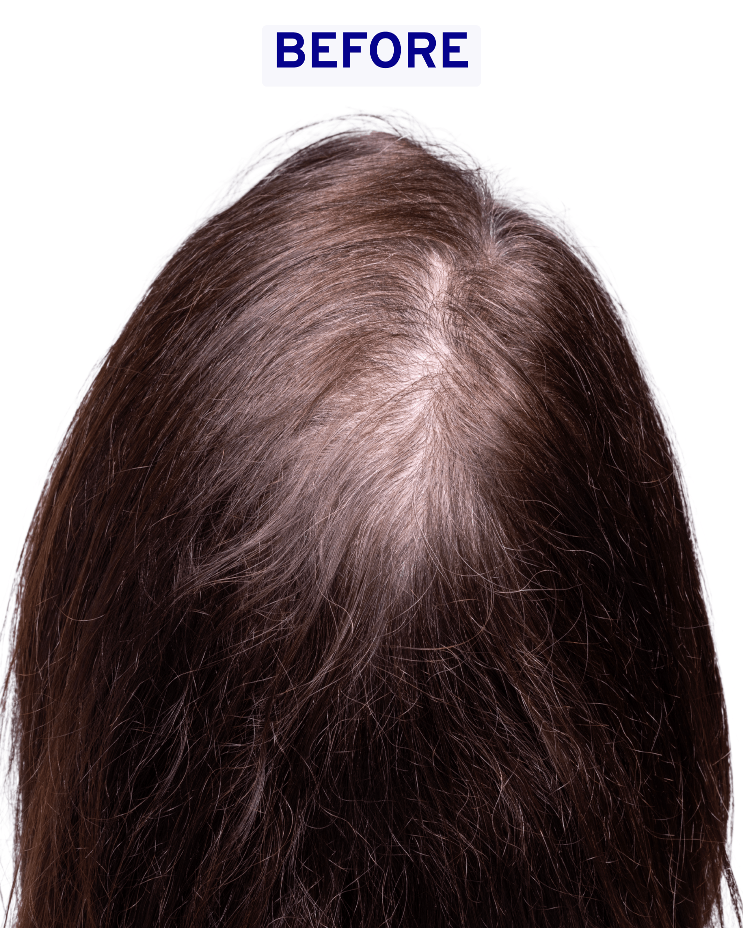 Nourish Hair & Scalp Serum